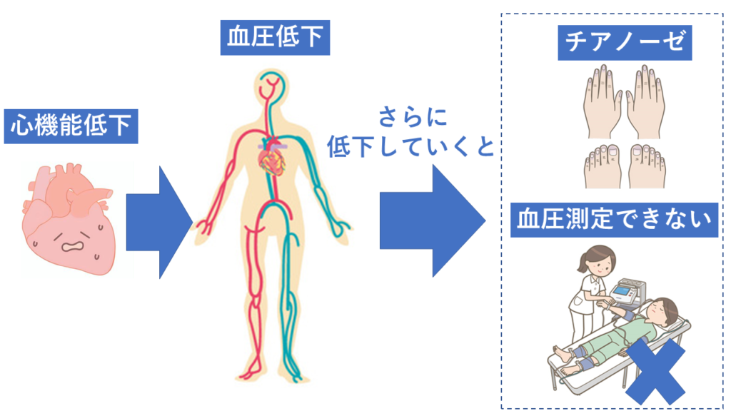 亡くなる前にみられる変化 訪問看護 訪問リハビリ 八尾市 にじリハ訪問看護ステーション